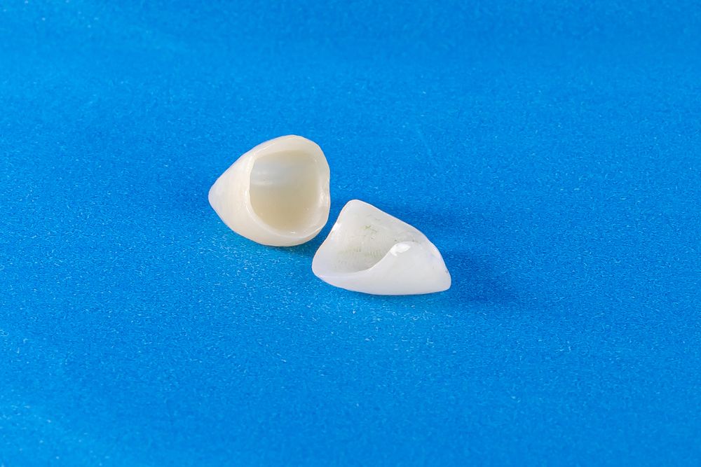 veneers and crowns 3Dental